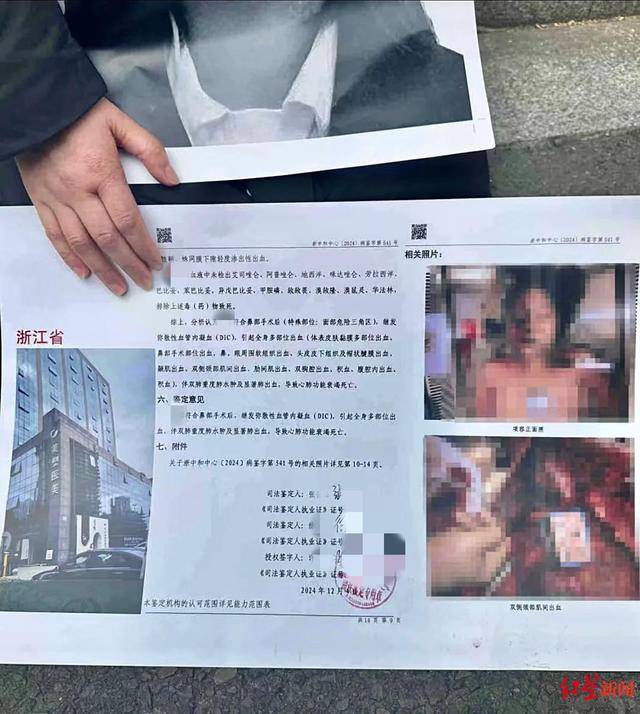 welcome皇冠注册_21岁女孩被曝做隆鼻手术后死亡welcome皇冠注册，宁波鄞州区卫健局：已介入调查